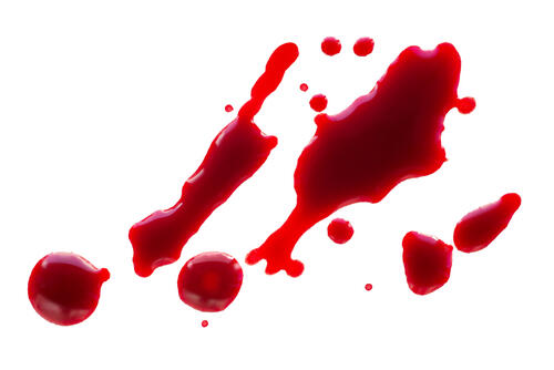 هل الدم في المنام يفسد الحلم تعرفوا على التفاصيل البوابة