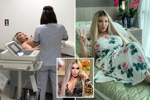 المتحولة جيسيكا ألفيس تستعد لاستئصال أكثر من نصف معدتها