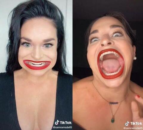 Video: Woman With 2.56-inch Mouth Gape Wins World Record