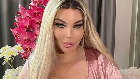 المتحولة جيسيكا ألفيس تستعد لاستئصال أكثر من نصف معدتها