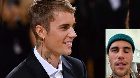 Justin Bieber Shares Updates on His Facial Paralysis Health Crisis