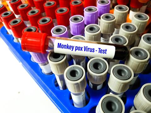 New Monkeypox Cases Discovered in Latin America