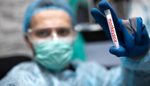 First Case of Monkeypox Reported in Washington