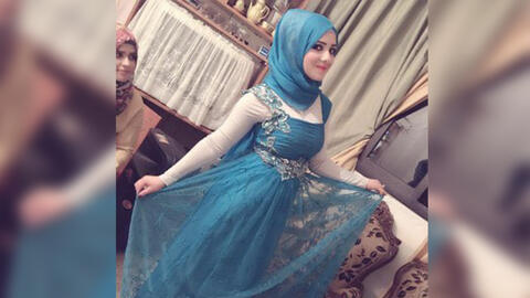 Burnet Alive! Lebanese Woman Dies After 11 Days