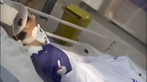 Mahsa Amini's story repeated! Armita Geravand in coma over hijab