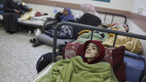  بسبب المجاعة .. وفاة 4 فلسطينيين بينهم طفلان بمستشفى كمال في غزة