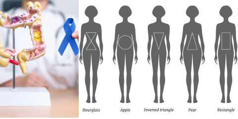  Body Shape Linked to Increased Risk of Colon Cancer, Study Finds