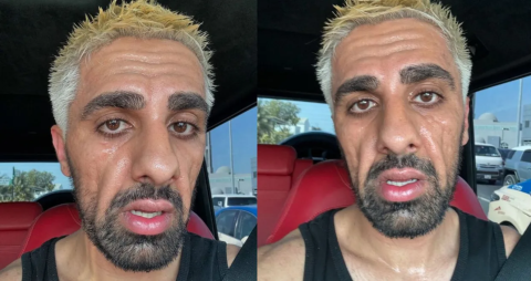 اليوتيوبر مو فلوغز يثير قلق متابعيه: عضلات وجهه انقبضت بشكل مخيف