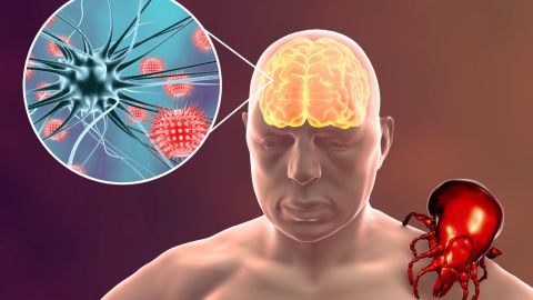 حمى غرب النيل: الأعراض، طرق الوقاية والعلاج