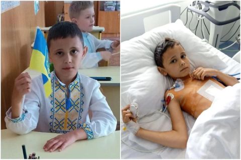 Ukrainian child who was at okhmatdy hospital dies days after Russian attack