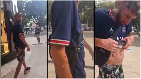 Man with Mpox freely wanders the streets in Paris!