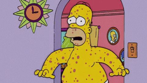 Laila Abdel Latif predicts Mpox! The Simpsons did it first