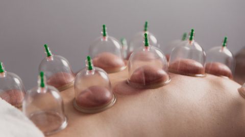 أفضل وقت لعمل حجامة في شهر نوفمبر 2025