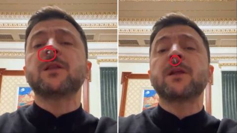 What dropped from Zelensky's nose?